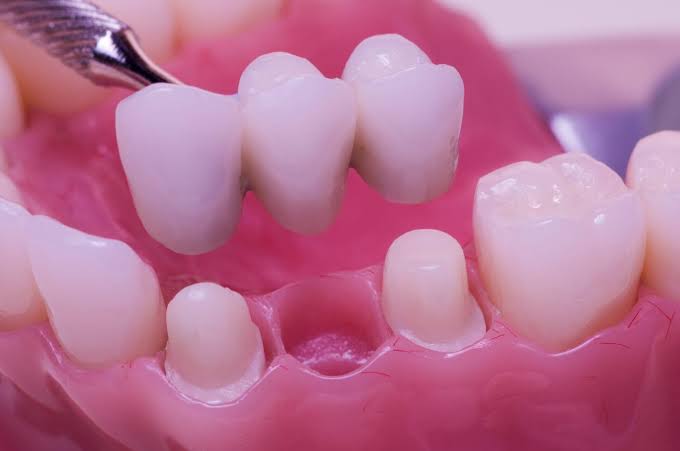 Restorative Dentistry